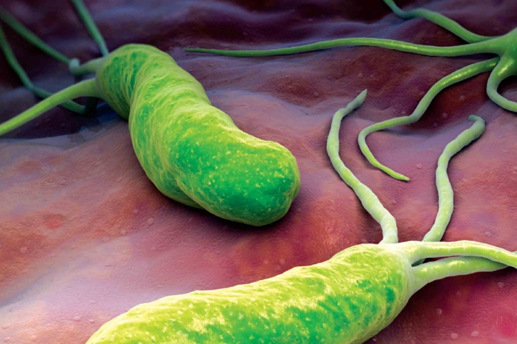 A gyomorfekélyt okozó baktérium ellen fejlesztettek növényi hatóanyagot szegedi és vajdasági kutatók