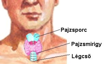 Ilyen problémákat okozhat a pajzsmirigygyulladás